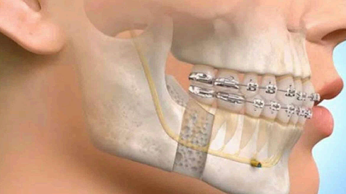 Oral and Maxillofacial Surgery