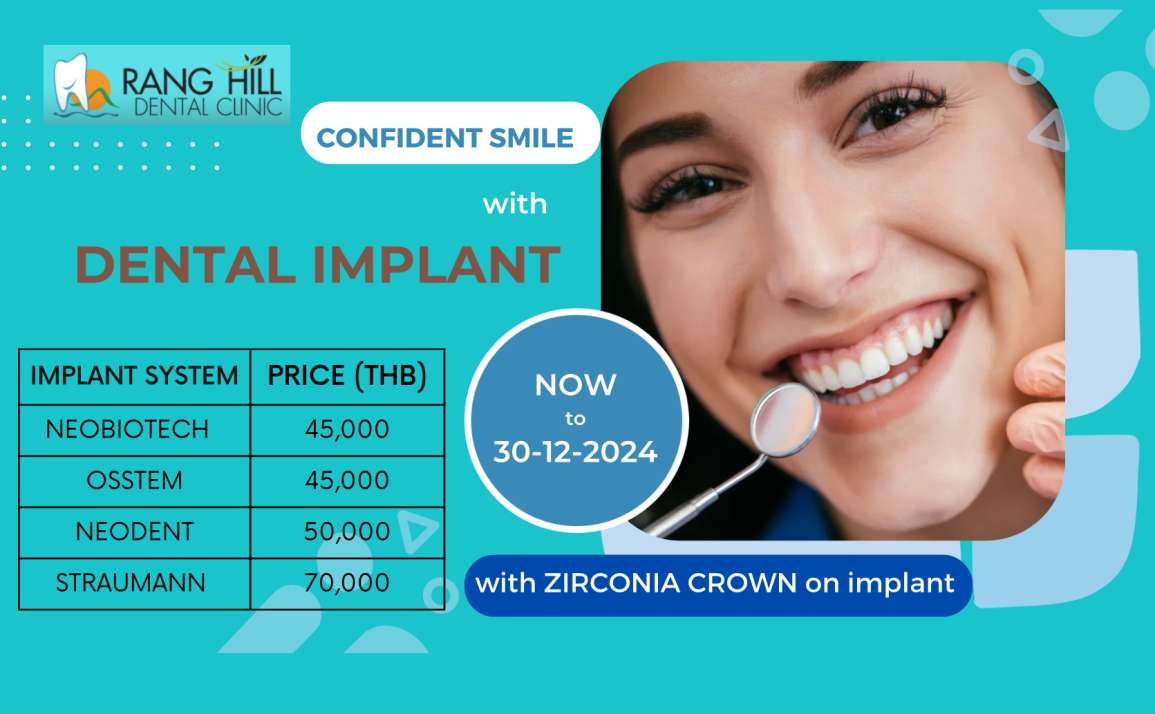 CONFIDENT SMILE WITH DENTAL IMPLANT