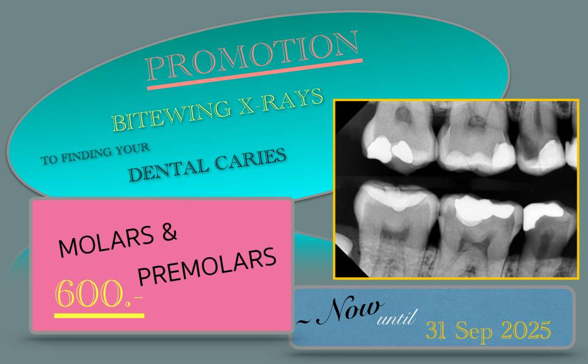 DIGITAL BITEWING X-RAYS